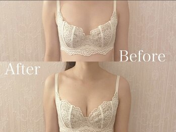 ジョリー(Jolie)/