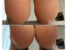 カシェット 広島店(Cachette)/50代女性☆足裏角質ケア60分