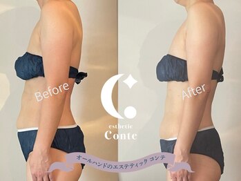 コンテ(Conte)/お腹の変化(遠赤痩身バンテージ)