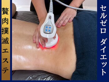 オーガスター(ORGASTAR)の写真/圧倒的効果◎【セルライトゼロでサイズダウン】ただ痩せるのではなく、美ボディへ☆