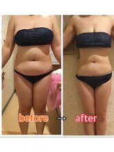 アンリール 旭川店(Anrire)/BODY施術のお客様です！