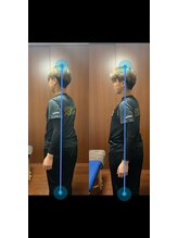 ヴィバランス(Vebalance)/矯正による体の変化