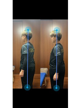 ヴィバランス(Vebalance)/矯正による体の変化