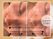 シミ、エイジングケアが同時進行できる本格的ケアが人気＾＾