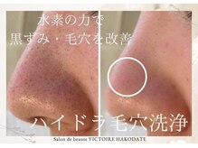 サロンドボーテ ヴィクトワール(Salon de beaute Victoire Hakodate)の雰囲気（毛穴・黒ずみ・開きを改善◎水素ピーリング）