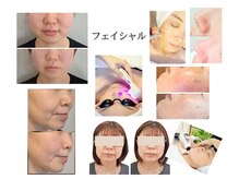 ララエピの雰囲気（お顔のお悩みご相談ください。毛穴ケア.小顔改善.肌質改善）