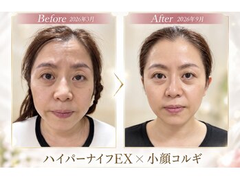 ルミア バイ ヒマワリ 練馬店(LUMIA by Himawari)の写真/首肩コリや頭痛に寄り添う結果重視の施術。小顔コルギで整う輪郭デザイン☆