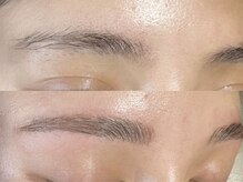 クラーム(klarm)/ハリウッドブロウリフト