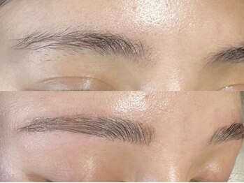 クラーム(klarm)/ハリウッドブロウリフト