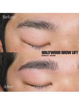 エレーナ(ELENA)/メンズハリウッドブロウリフト