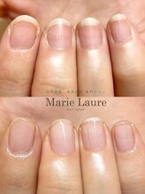 マリーロール 淀屋橋本店(Marie Laure)/自爪育成/深爪矯正/ネイルケア