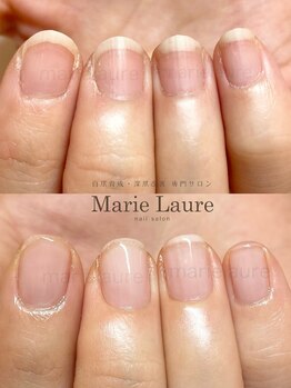 マリーロール 淀屋橋本店(Marie Laure)/自爪育成/深爪矯正/ネイルケア