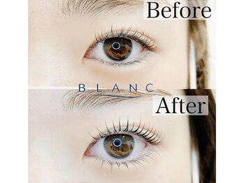 アイラッシュサロン ブラン さんすて倉敷店(Eyelash Salon Blanc)の写真/【上下まつげパーマでパッチリまつげ!】雰囲気や目元のバランスに合わせデザイン提案♪パリジェンヌ取扱！