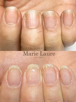 マリーロール 梅田店(Marie Laure)/深爪改善/自爪育成/ネイルケア