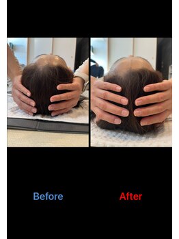 整体院 長谷川/頭蓋骨調整もやります