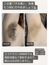 ホッコリ 段原店(HOKKORI)&nbsp;HOKKORI 