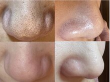 ジェリー(JERRY)の雰囲気(顔の毛穴は約20万個!まずは毛穴汚れを一掃するのが美肌への近道)