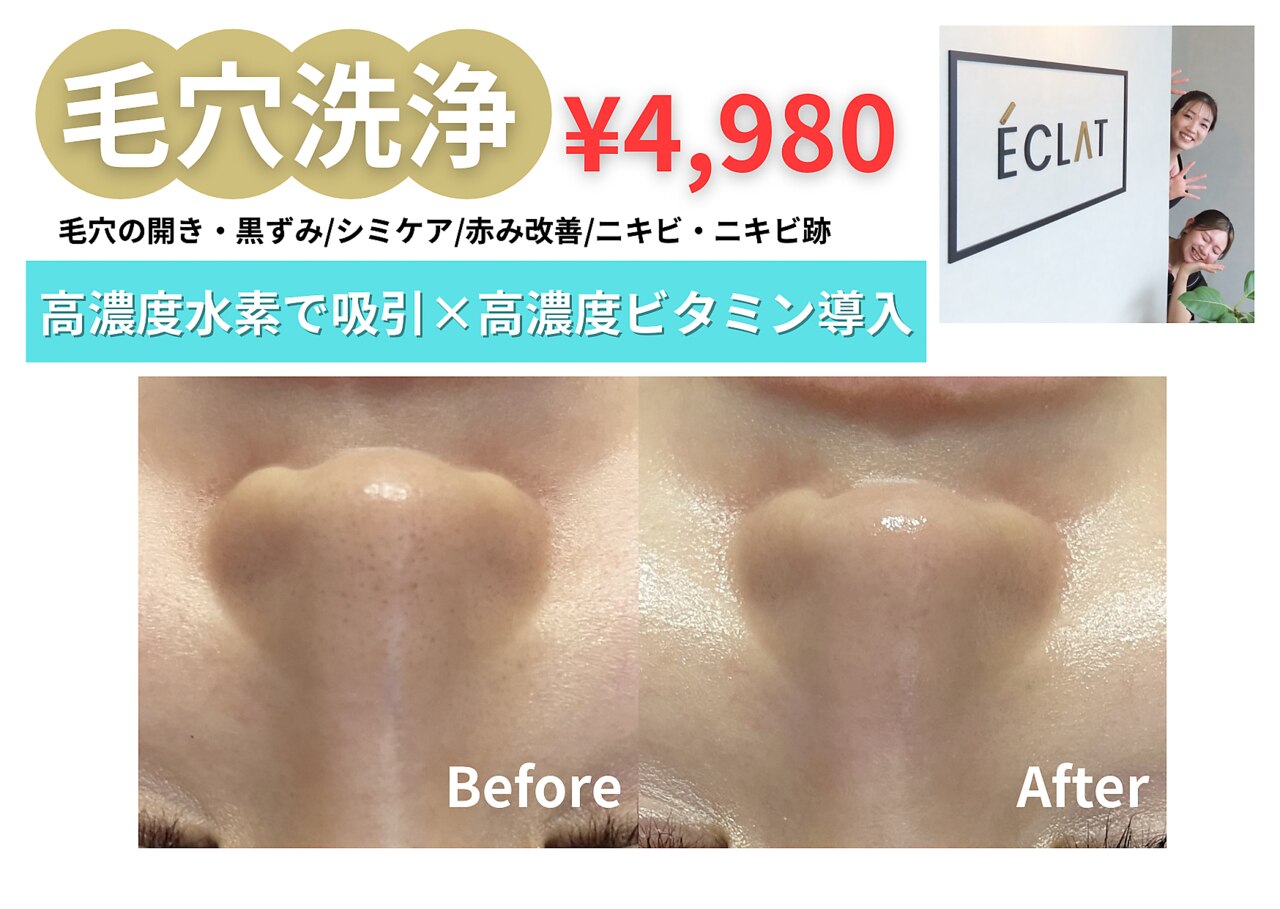 エクラ(ECLAT)｜ホットペッパービューティー