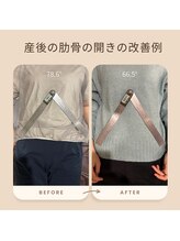和ぎ整体院/肋骨矯正で改善