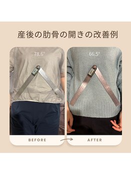 和ぎ整体院/肋骨矯正で改善