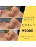 【6/10限定】黒ずみ毛穴集中！！溶ける角栓毛穴吸引&洗浄¥5000