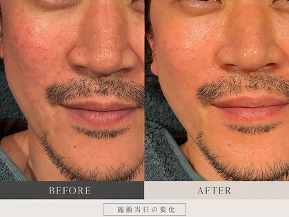カズキ ハギワラ(Kazuki Hagiwara)の写真