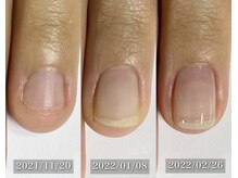 ネイルサロン エルフ(NailSalon)の雰囲気（深爪・噛み爪・横広な男爪でお悩みの方に向けた育成メニュー）