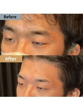 眉毛ハウス 吉祥寺店(眉毛HOUSE)/お客様の施術例(吉祥寺/東京)