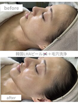 ラ ミュエル(La miel)/韓国ラハピール