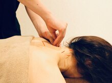 クマノミ美容鍼灸 春日部院(KUMANOMI美容鍼灸)/首肩の盛り上がり,こりにも対応!