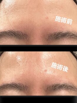 ツール(TOOL)/肌質根本から改善！