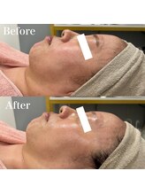 ジョアアンジェ 京橋店(joie ange)/ララピール1回