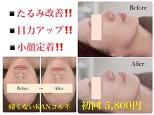 アロンジェファム(allonge femme)
