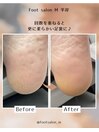 【足裏角質ケア】 50代男性