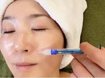 ルミエール フォレストサイド(L’MIERE forestside)の写真/目元/ほうれい線/眉間シワケアに◎《NEW!マイクロニードルケア》衰え肌を程よく刺激し自発的に細胞活性化!