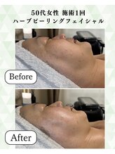 シーフェイス 横浜店(SEE FACE)/定期的なケアで肌質改善を叶える