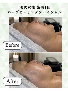 シーフェイス 横浜店(SEE FACE)/定期的なケアで肌質改善を叶える