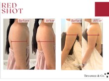 アンシャンテ(Anchant)/【レッドショット】