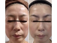 コルッソ(CoLusson.)の雰囲気（たるみケア/お肌質改善/くすみ/乾燥肌/5.10年後も若々しいお肌を）