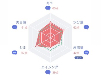 エイチズ(H's)/自分の肌を細かく分析できる!