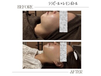 サロン ナビ(salon nabi.)/レモンボトルbefore→after♪