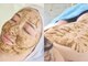 ライム 西船橋(LIME)の写真/大人ニキビケア・背中ニキビケアには【剥けないハーブピーリング】!!赤みやポツポツのないツルツル素肌へ◎