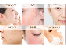 ジョイアエテルナ(gioia eterna)/光トり－トメントメニュー