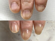 ハッチネイル(HACCI nail)