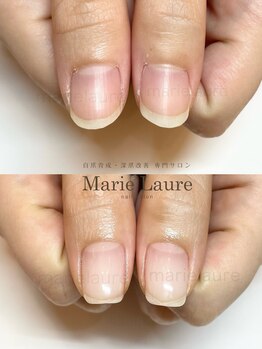 マリーロール 淀屋橋本店(Marie Laure)/自爪育成/深爪矯正/ネイルケア