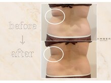 アンバー 恵比寿(AMBER)/腰についたお肉もスッキリ！