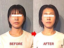 アトラス/初回のお客様のBefore＆after