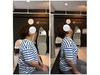 ナオル整体 広島福山院(NAORU整体)/肩こり/首こり→Before/After