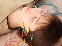 ハリノヒ 本町院/ 美容鍼でエラ張り・たるみ改善