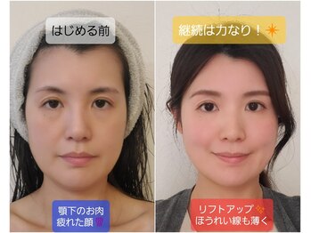 プリマ(prima)/4D小顔クリーム、オススメです